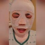 South Korean man allegedly pours hot water over Thai girlfriend out of jealousy | Thaiger