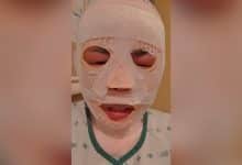 South Korean man allegedly pours hot water over Thai girlfriend out of jealousy | Thaiger