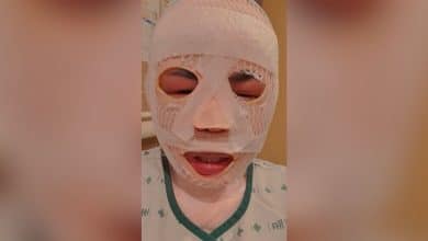 South Korean man allegedly pours hot water over Thai girlfriend out of jealousy | Thaiger