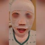 South Korean man allegedly pours hot water over Thai girlfriend out of jealousy | Thaiger