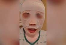 South Korean man allegedly pours hot water over Thai girlfriend out of jealousy | Thaiger