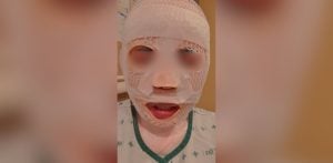 South Korean man allegedly pours hot water over Thai girlfriend out of jealousy | Thaiger