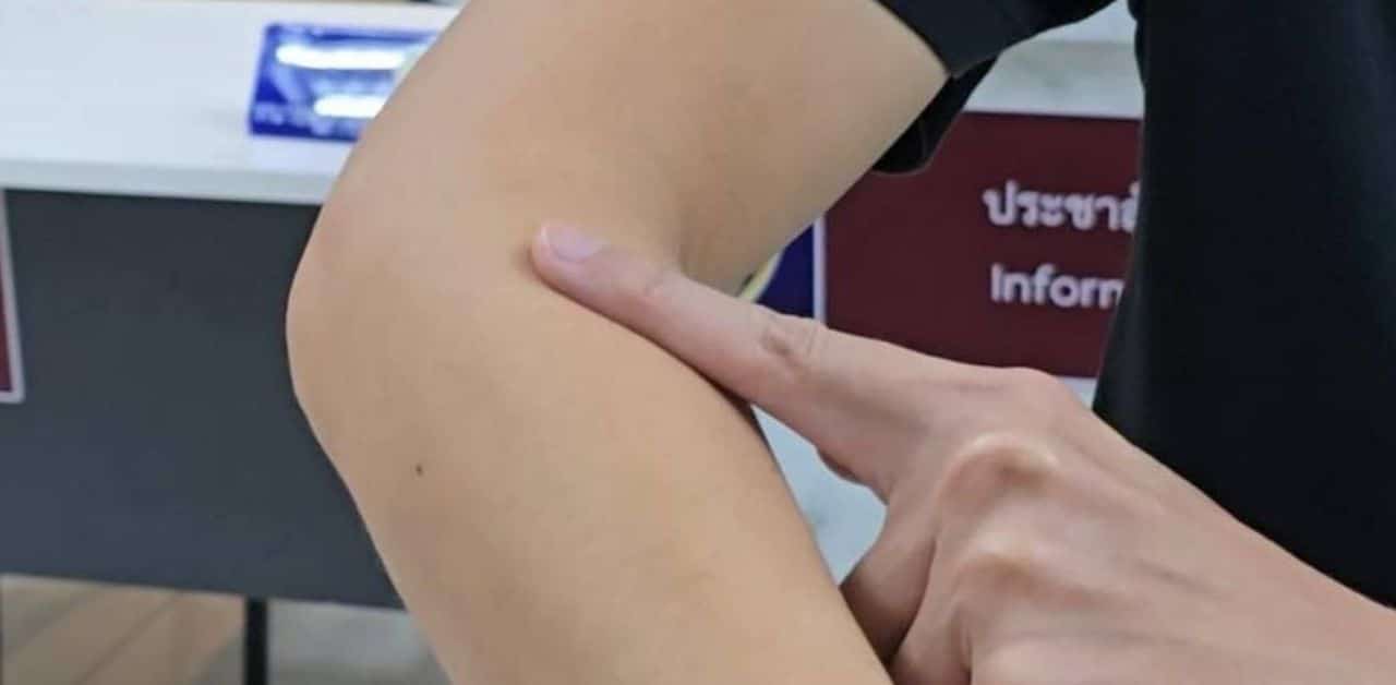 Found blood smeared on arm while on Bangkok MRT