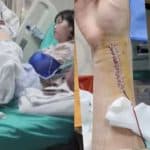 Foreign student injured in Chiang Rai car crash seeks accountability | Thaiger