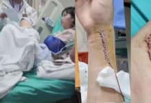 Foreign student injured in Chiang Rai car crash seeks accountability | Thaiger