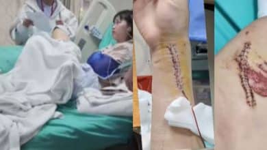 Foreign student injured in Chiang Rai car crash seeks accountability | Thaiger