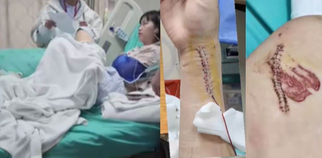 Foreign student injured in Chiang Rai car crash seeks accountability | Thaiger