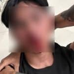 ‘She said she was single’: Pattaya man says lie leads to assault and false theft accusation | Thaiger