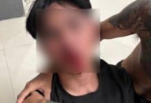 ‘She said she was single’: Pattaya man says lie leads to assault and false theft accusation | Thaiger