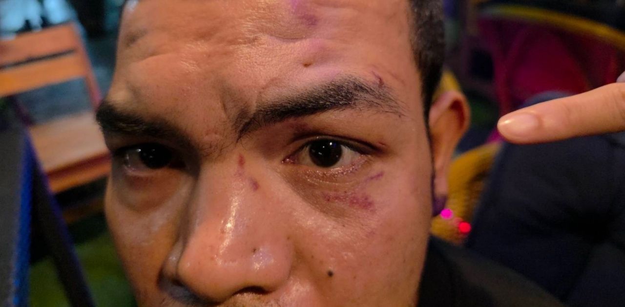 Thai man accused police of attacking him