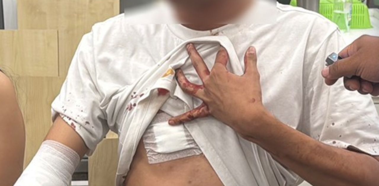 Thai bar guard stabbed in Pattaya