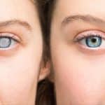 Diabetic Retinopathy: What you really need to know about your eyes and diabetes | Thaiger