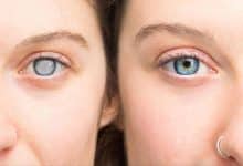 Diabetic Retinopathy: What you really need to know about your eyes and diabetes | Thaiger