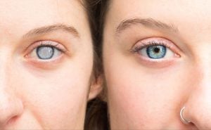 Diabetic Retinopathy: What you really need to know about your eyes and diabetes | Thaiger