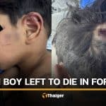 4 year old boy brutally assaulted by grandmother’s boyfriend | Thaiger