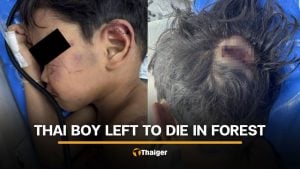 4 year old boy brutally assaulted by grandmother’s boyfriend | Thaiger