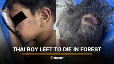 4 year old boy brutally assaulted by grandmother’s boyfriend | Thaiger