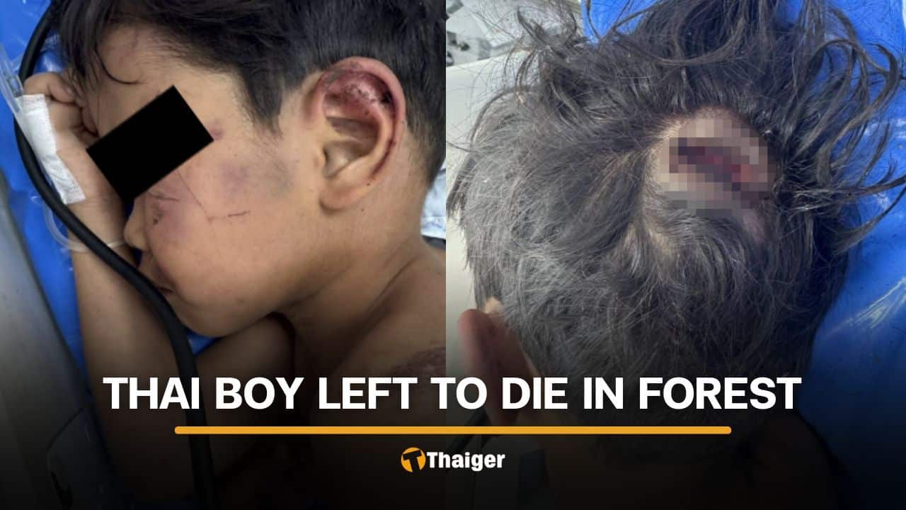 4 year old boy brutally assaulted by grandmother’s boyfriend | Thaiger