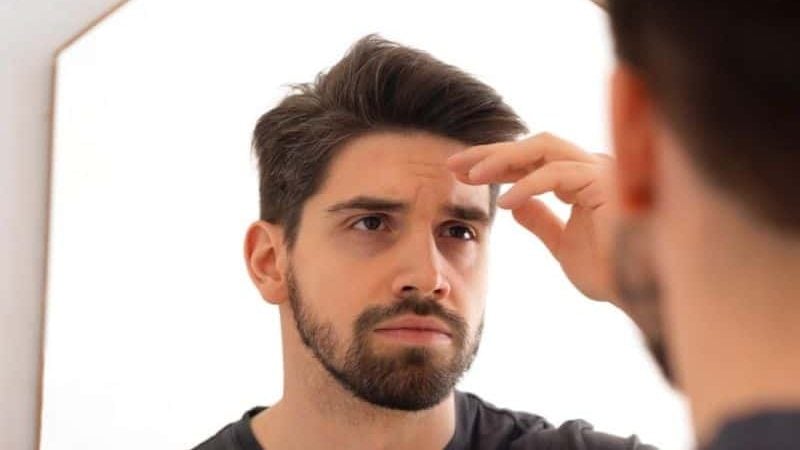 Man with a full head of hair