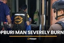 Lopburi man severely burned after two-hour disappearance | Thaiger
