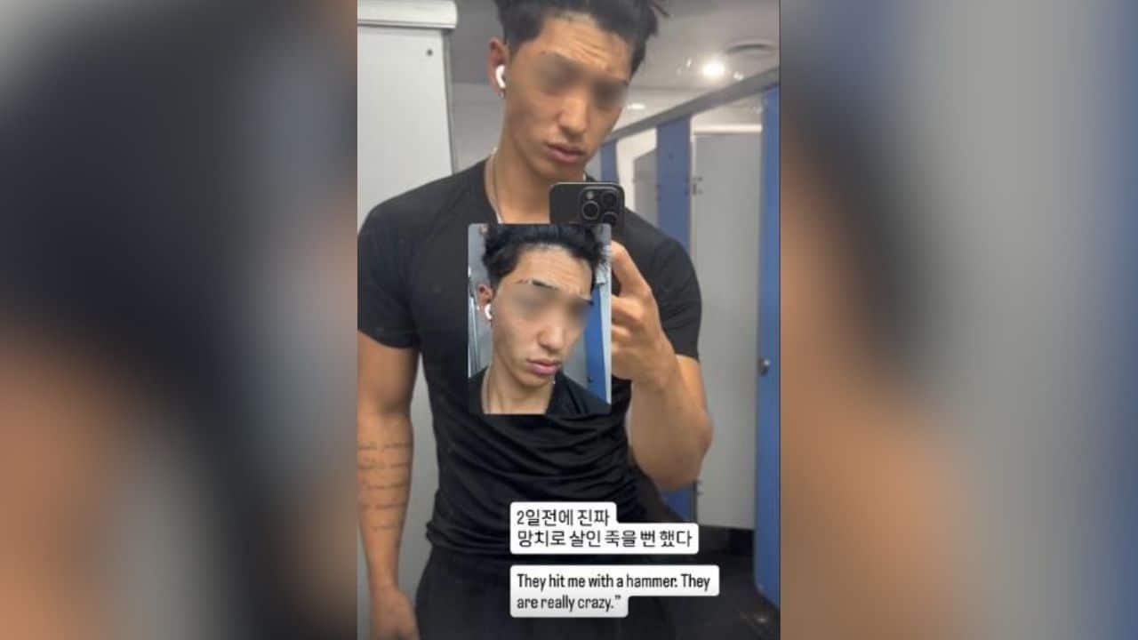 South Korean injured by hammer in Sydney, Australia