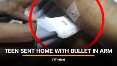 Bangkok hospital criticised after bullet left in teen’s arm | Thaiger