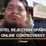 Thai man rejected by Kanchanaburi hotel allegedly due to his appearance | Thaiger