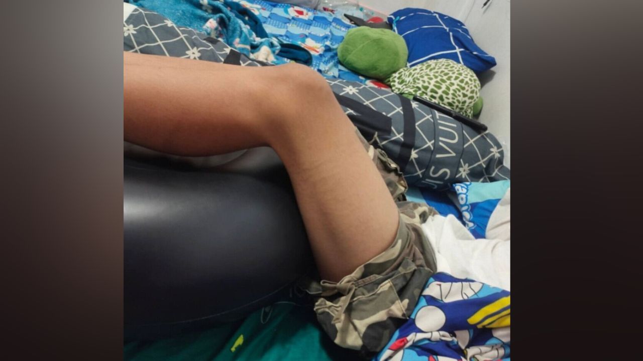 Injured Thai student rests at home after being hospitalised for muscle strain caused by excessive punishment