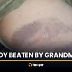 Thai boy found with bruises after being beaten by grandmother | Thaiger