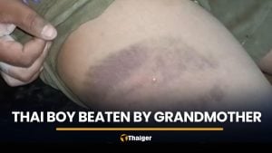Thai boy found with bruises after being beaten by grandmother | Thaiger