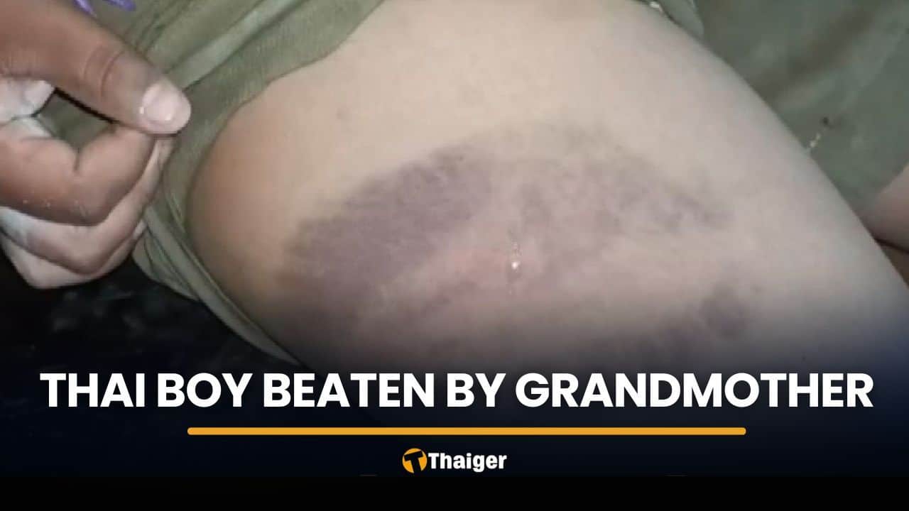 Thai boy found with bruises after being beaten by grandmother | Thaiger
