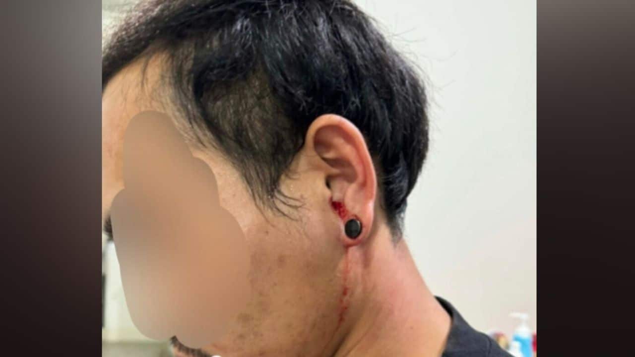 Close-up of Ying’s brother’s injured ear after physical altercation in Rayong