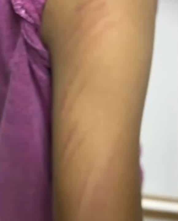 Complaint filed after teacher repeatedly hits student as punishment