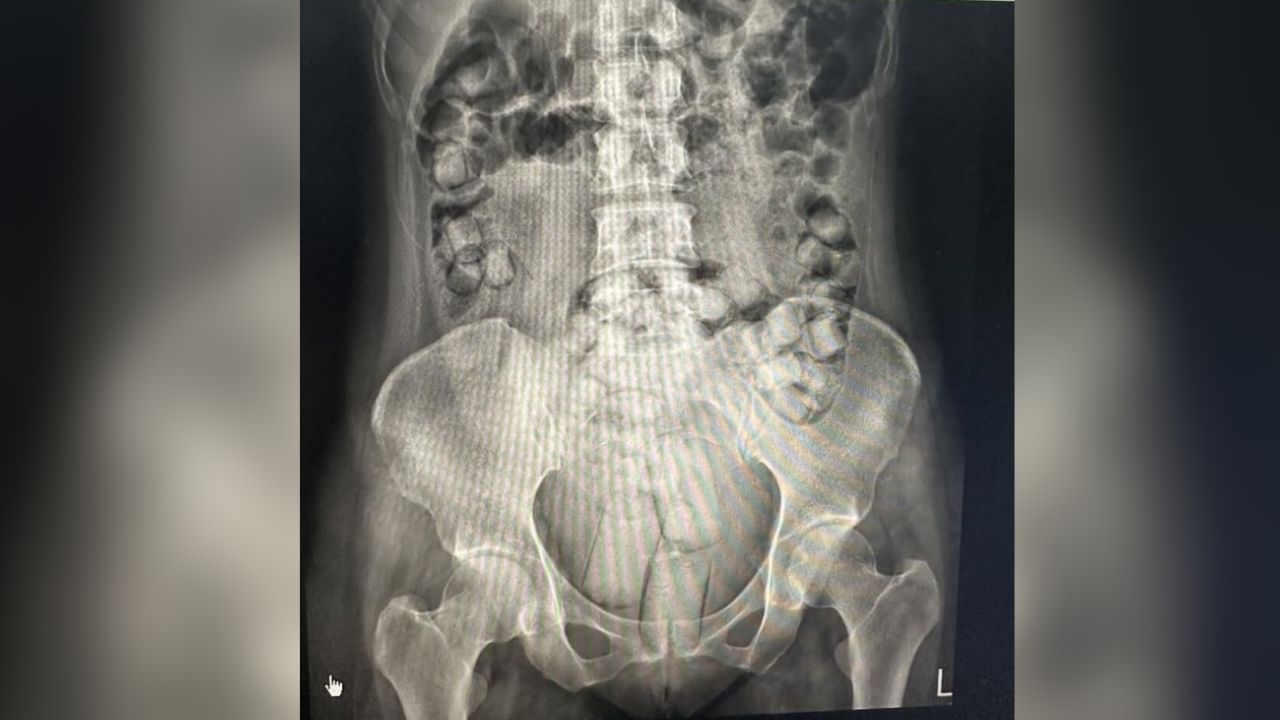 Thai women imprisoned for smuggling drug into Taiwan