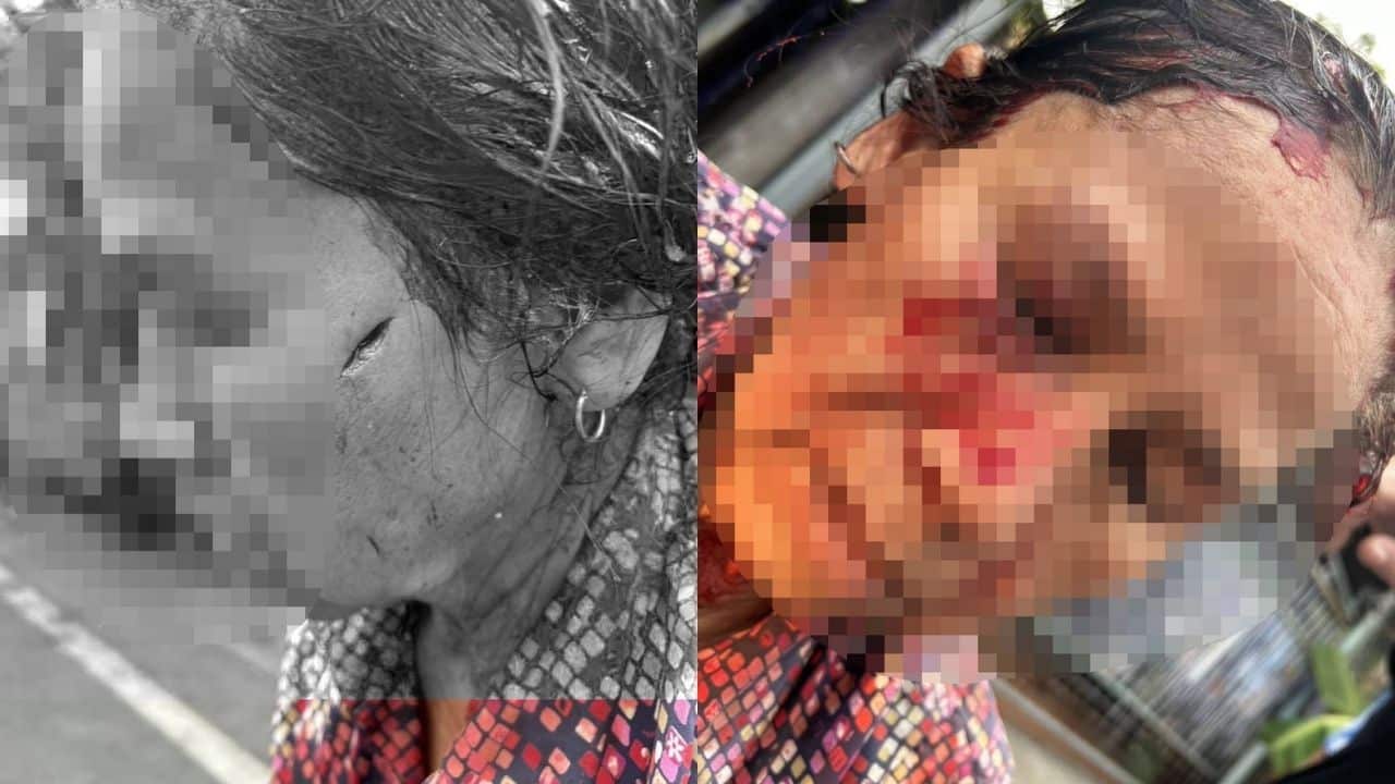 Old woman attacked by put bull in Samut Prakan
