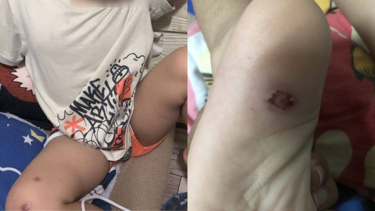 Fatal assault on three year old boy