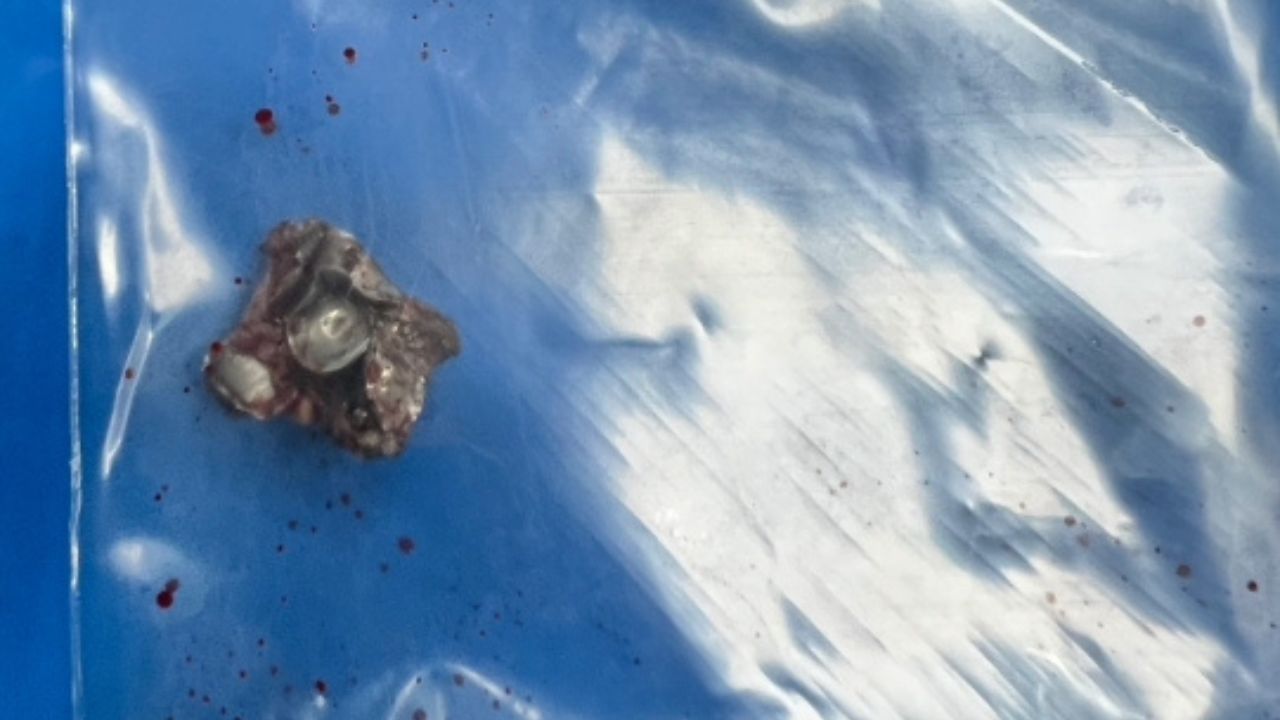 Chinese tourist struck in the face by bullet at Phuket shooting range