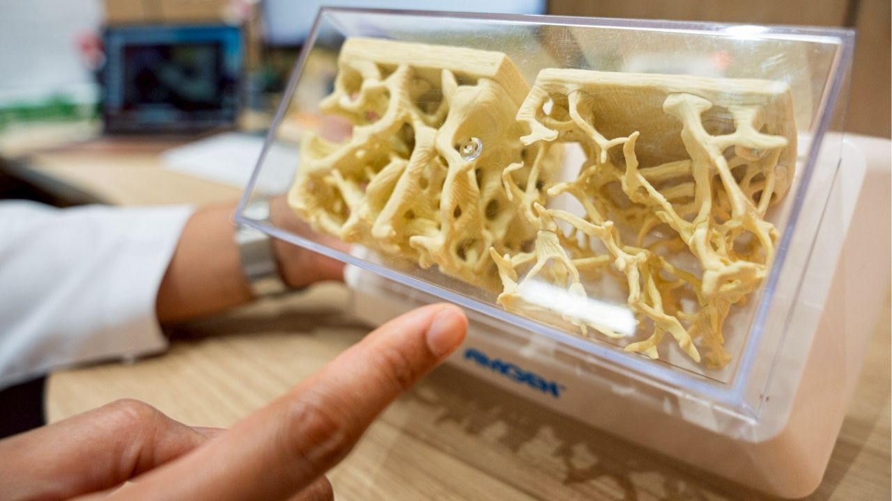 A model demonstrates healthy bone versus osteoporosis, emphasizing the importance of bone health.