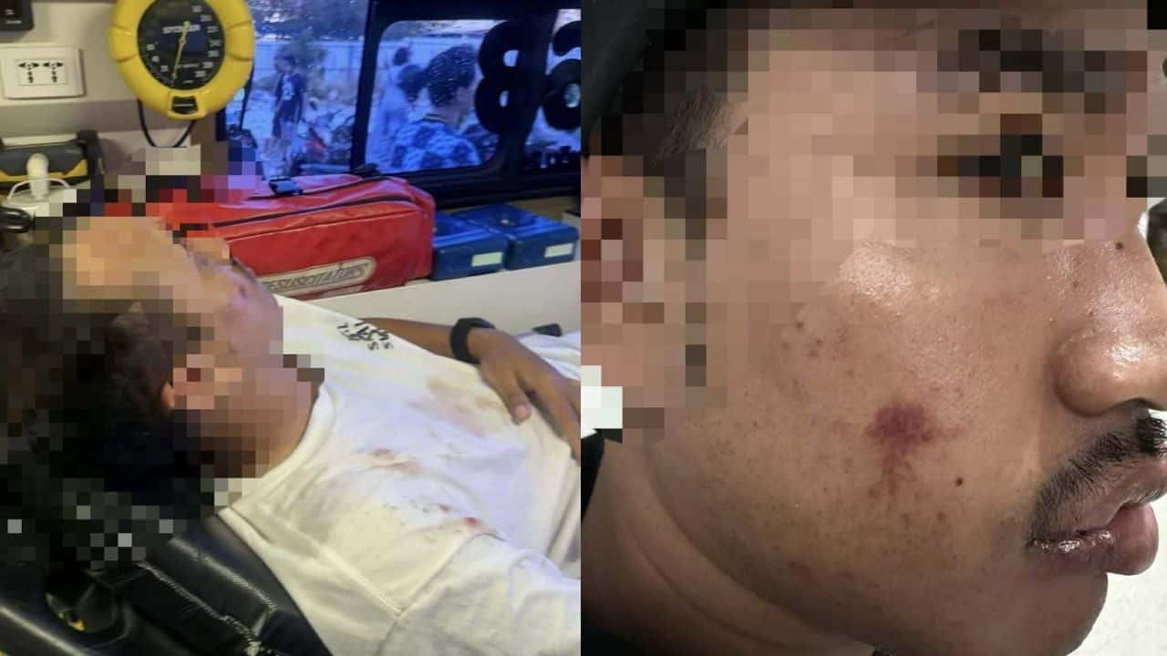Thai man attacked by foreigners in Phuket