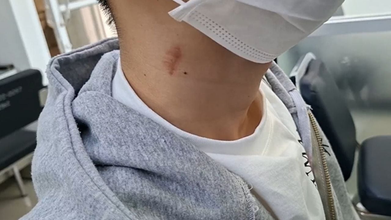 Transwomen leave hickey on victim's neck in Songkran