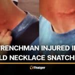 French tourist injured in gold necklace snatching in Phuket | Thaiger