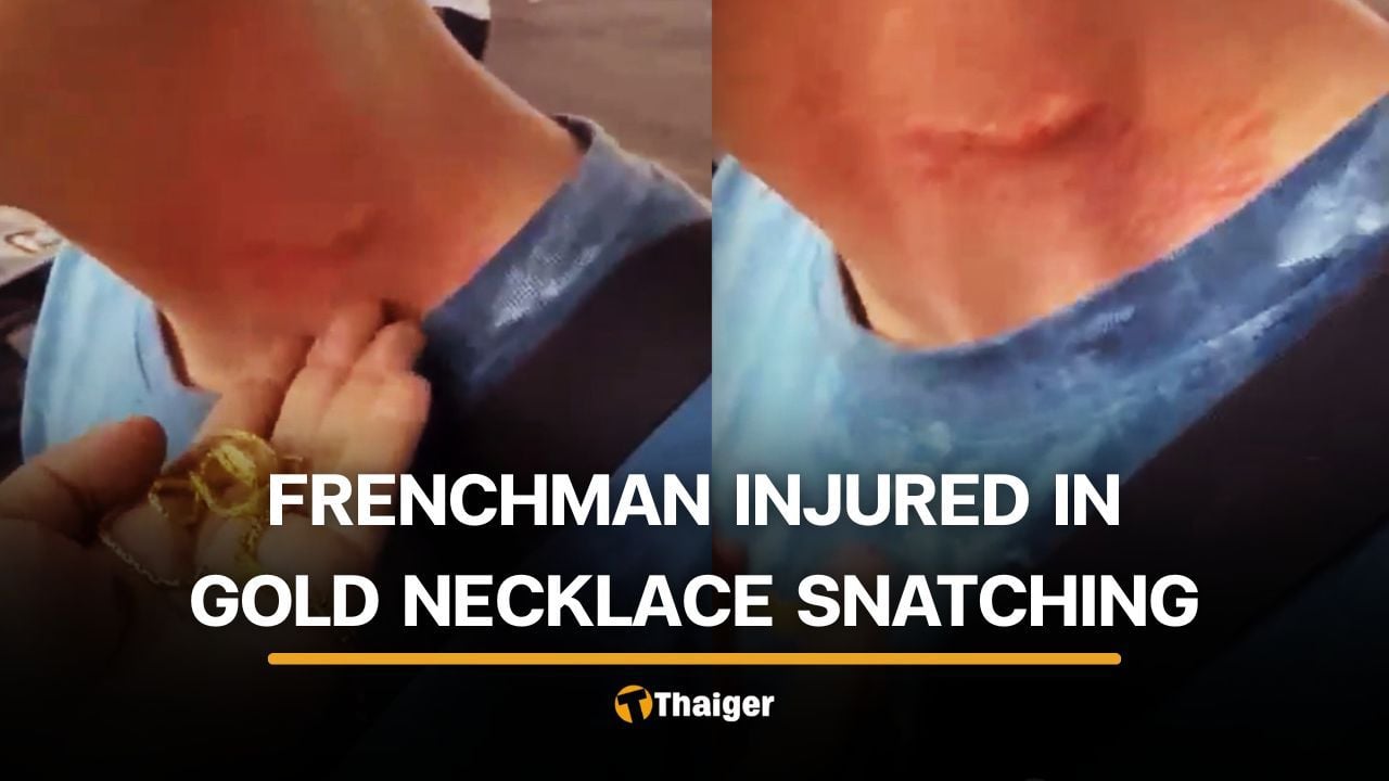 French tourist injured in gold necklace snatching in Phuket | Thaiger