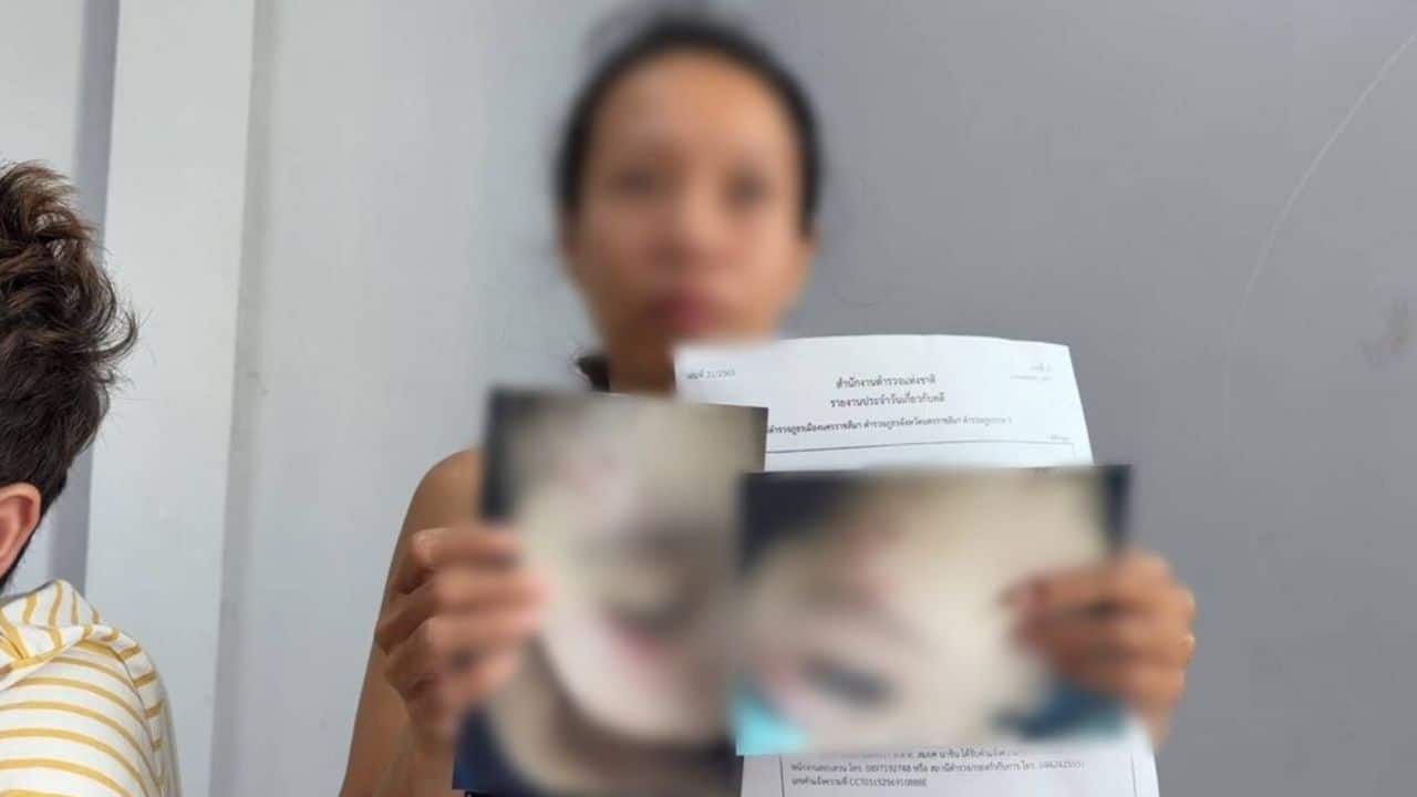 A Nakhon Ratchasima teacher was accused of hitting a boy with a broom after a mother filed a police complaint over his injuries.