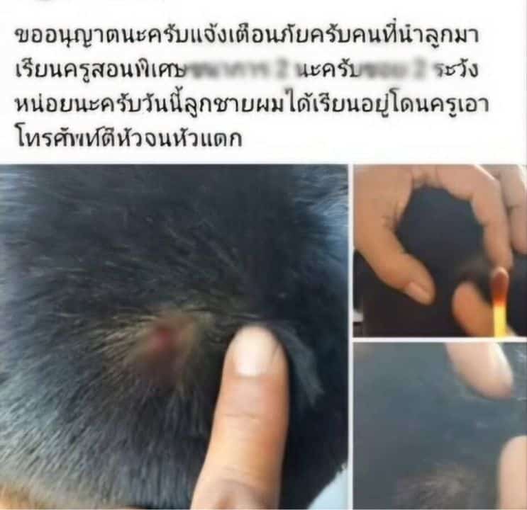 Police in Saraburi are investigating after a father said a tutor hit his seven year old son on the head with a mobile phone.