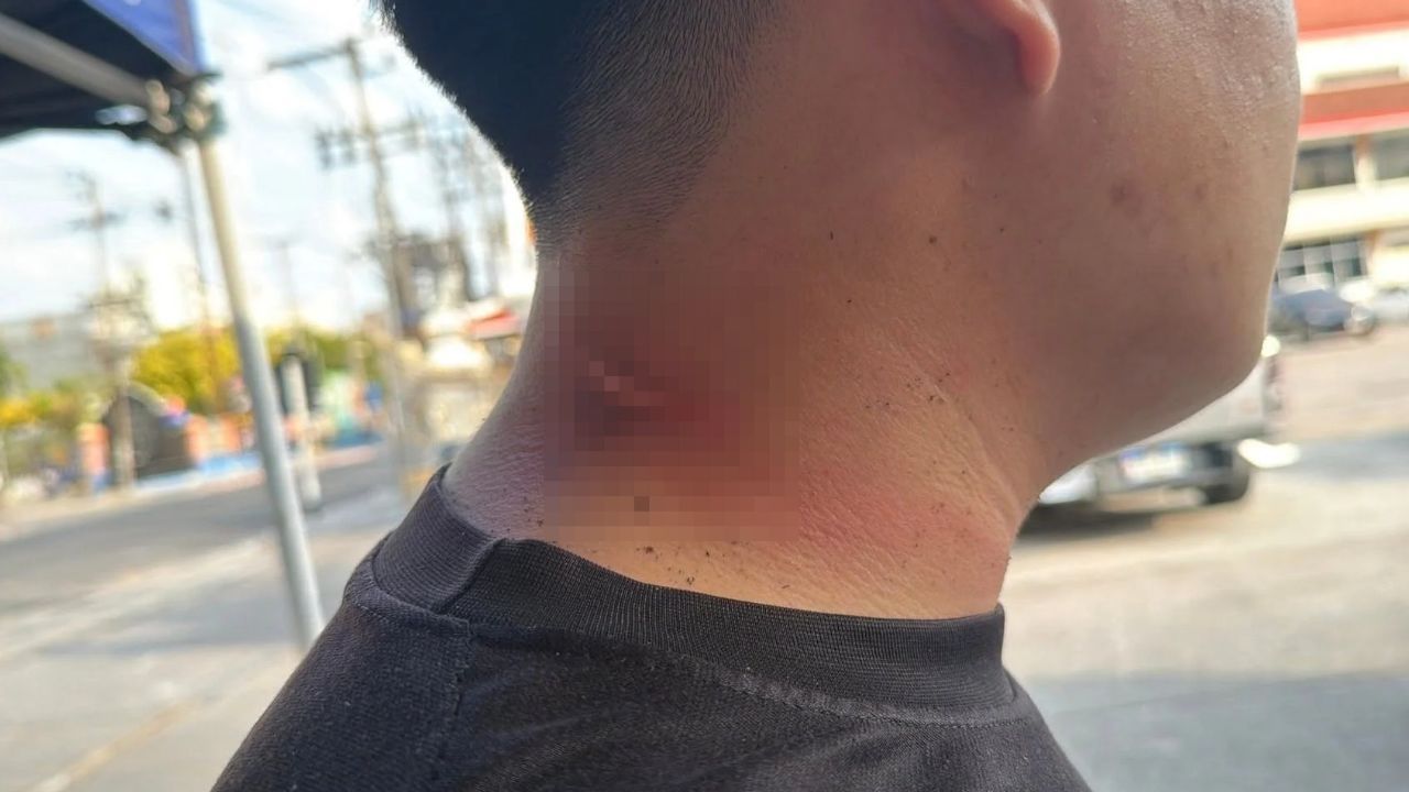 A rescue worker in Pattaya suffered a deep neck wound after a low-hanging internet cable caught him while he was riding a motorcycle.