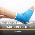 ‘Motion is life’ — What one orthopaedic trauma specialist wants you to know | Thaiger