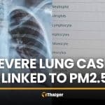 Chiang Mai doctor reports severe lung cases tied to PM2.5 | Thaiger