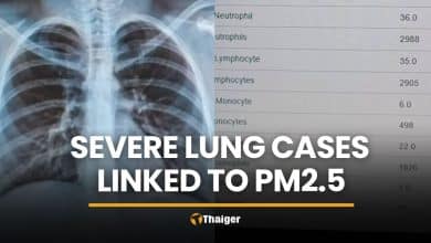 Chiang Mai doctor reports severe lung cases tied to PM2.5 | Thaiger