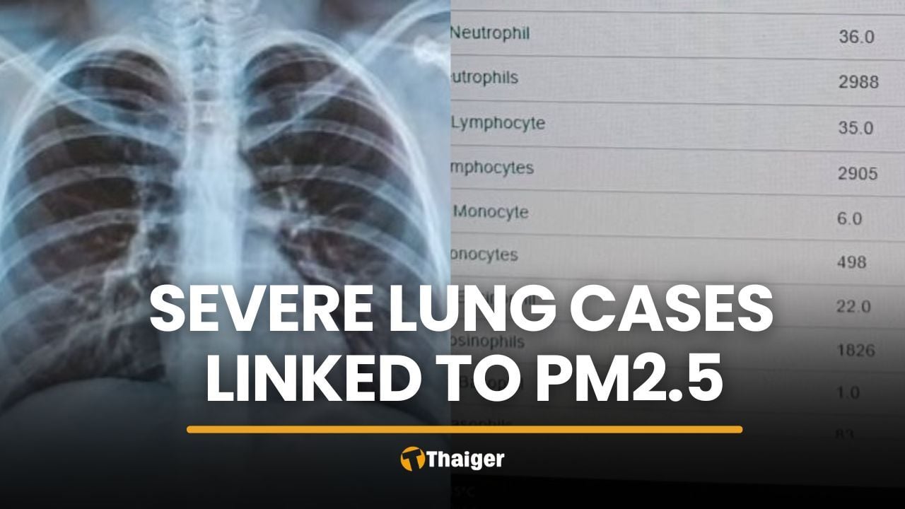 Chiang Mai doctor reports severe lung cases tied to PM2.5 | Thaiger