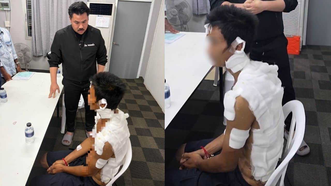 Burmese man assaulted by Chinese nationals in Rayong